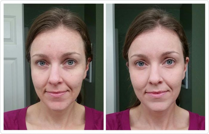 A before-and-after image showing a reviewer who used the palette to completely conceal dark circles.