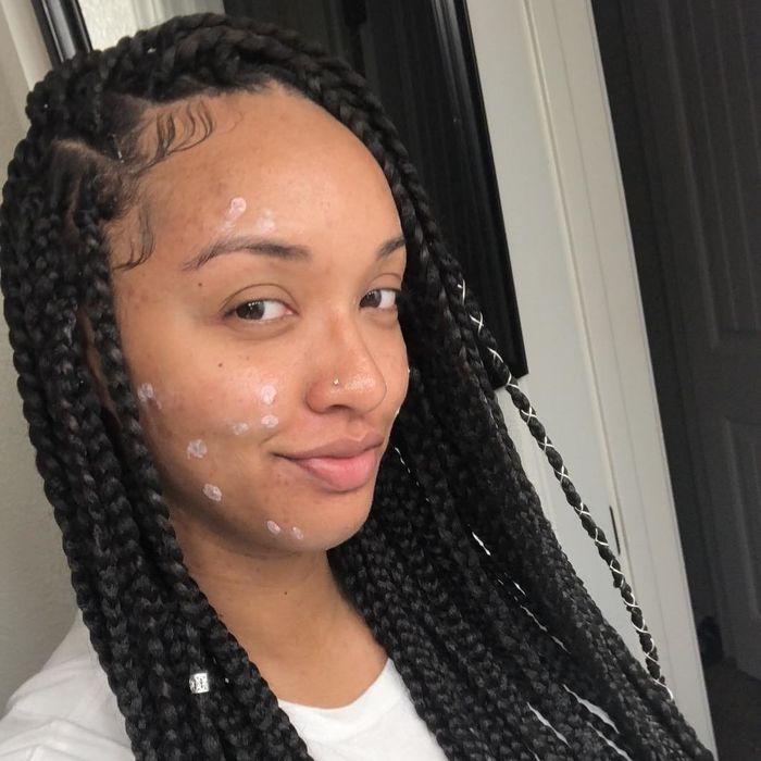 A reviewer using the spot treatment.