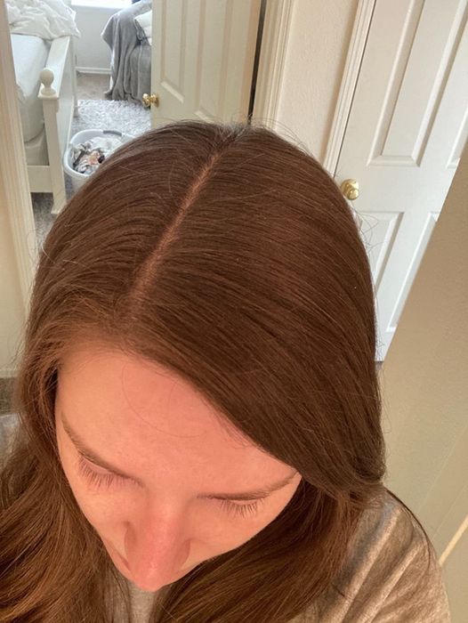 After: Same reviewer with less greasy strands after using the dry shampoo above