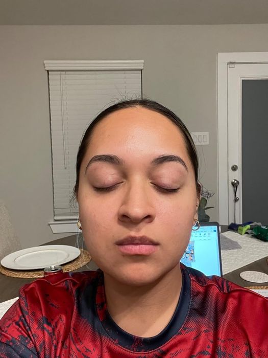 Reviewer after applying acne spray