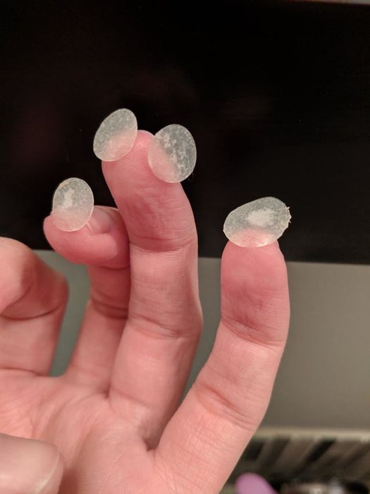 A reviewer's used pimple patches.
