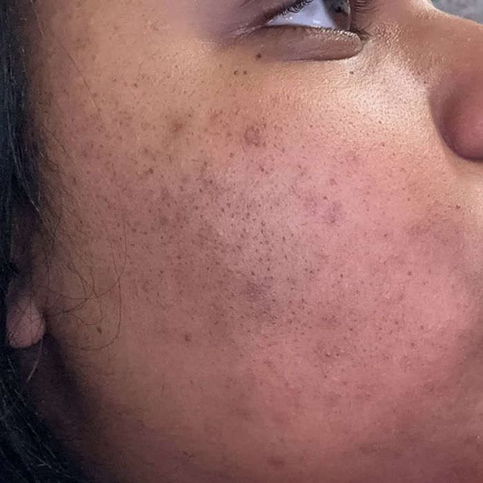 Close-up of a person's cheek.