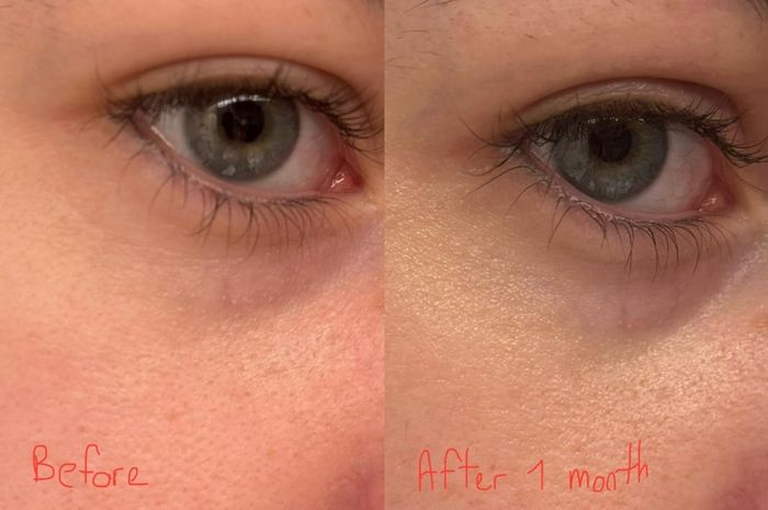 Reviewer before and after applying eye cream