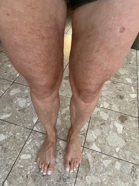 Reviewer's legs after applying Bum Bum Cream