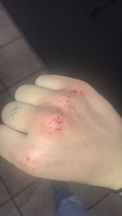 Reviewer's hand before applying hand cream