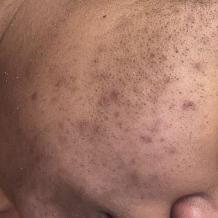 Close-up of a person's cheek.