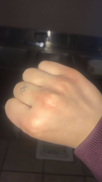Reviewer's hand after applying hand cream