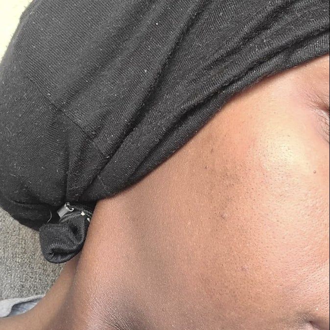 A close-up shot of a person's cheek.