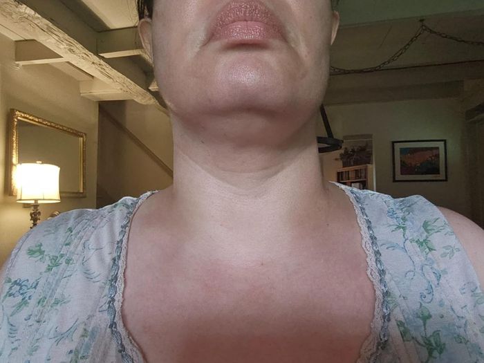 Reviewer's neck following the use of the cream