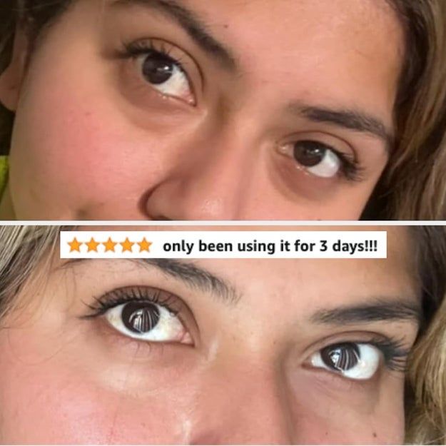 reviewer demonstrating the improvement in their under-eye area after 3 days of using the cream, showing reduced dark circles and a brighter overall appearance