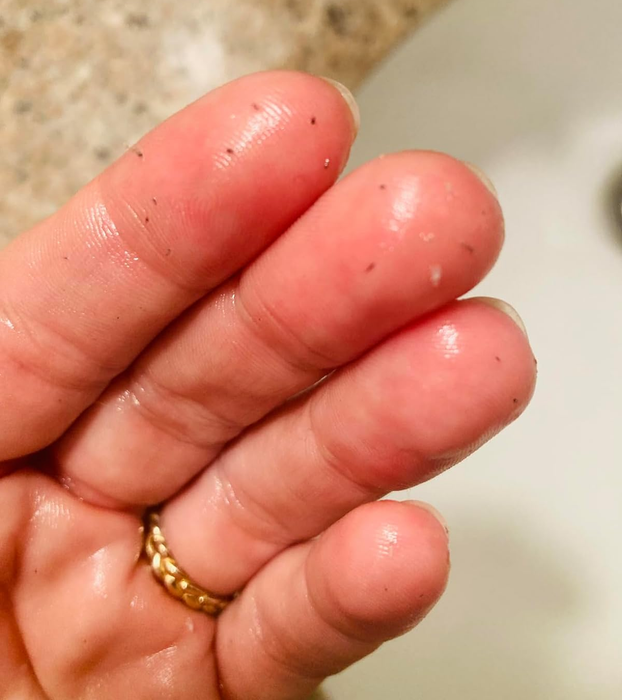 A reviewer's hands showing the dead skin that was removed after using the cleanser