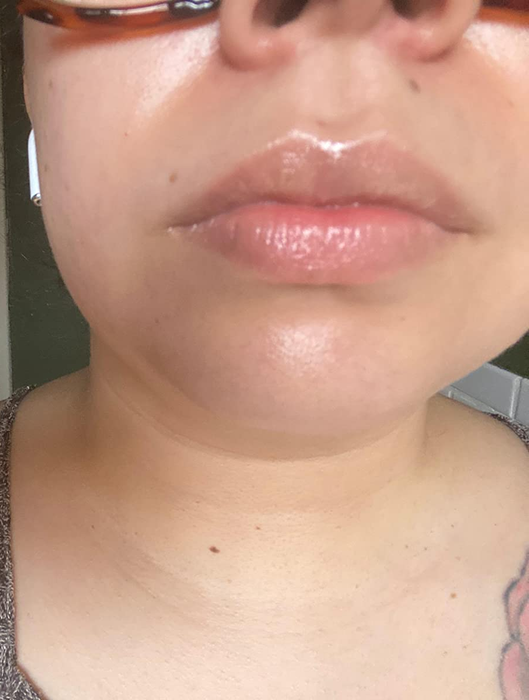 Close-up of the reviewer’s lips looking soft, smooth, and moisturized after using the mask.
