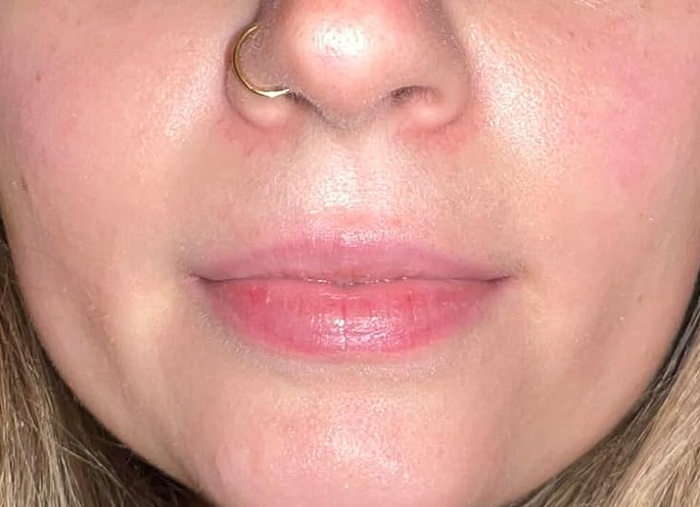 Close-up of a person's lower face, showcasing well-hydrated lips