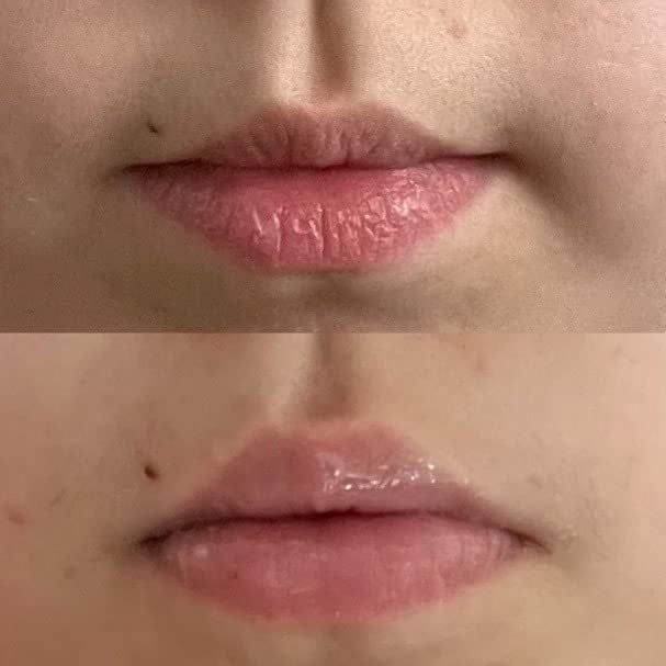 Close-up comparison of lips before and after using lip treatment