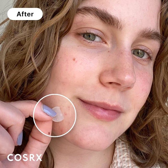 Woman demonstrating visible skin improvement while using a COSRX product, holding a patch on her cheek