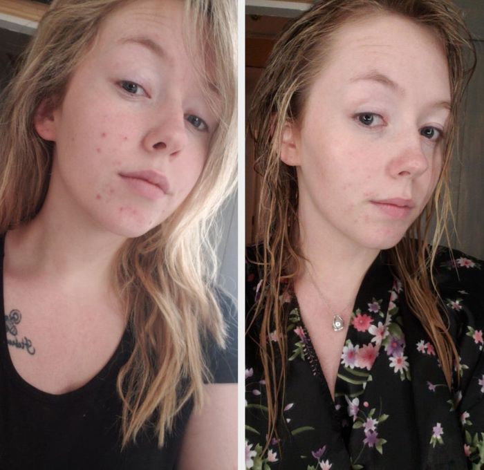 A before-and-after photo of a reviewer after one week of using the Neutrogena gel cream. On the left, their skin appears dull with some redness, while on the right, it looks smoother, brighter, and almost dewy.