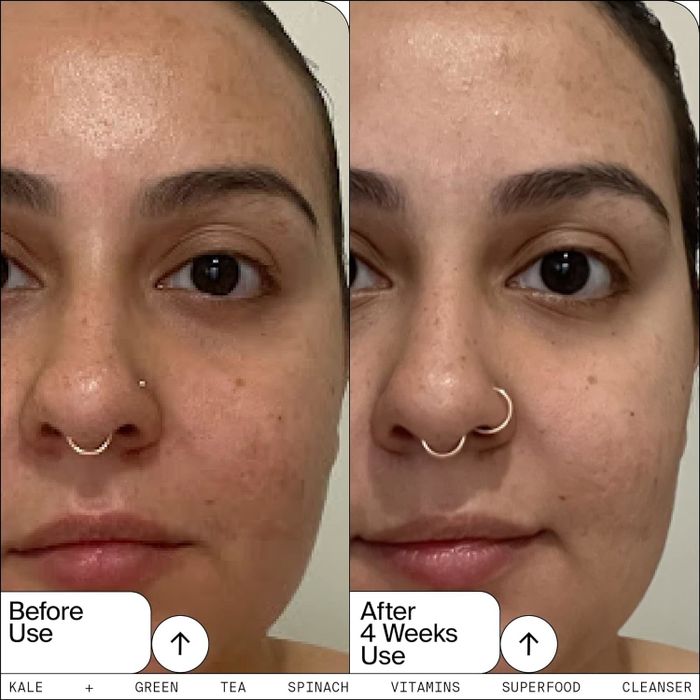 Before and after skincare comparison showing noticeable improvement in complexion after 4 weeks of use.