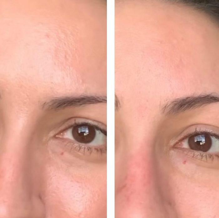 Reviewer showing the matte finish after using the Revlon volcanic facial roller, visibly reducing shine
