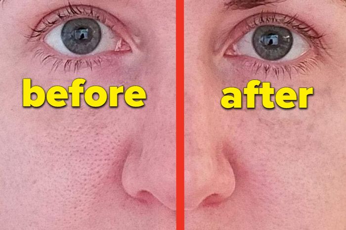 a reviewer showcasing how the pore filler visibly smooths large pores on one side of their face