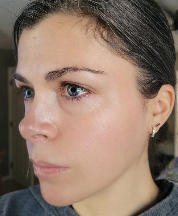 image of a reviewer with glowing, healthy skin after using the serum