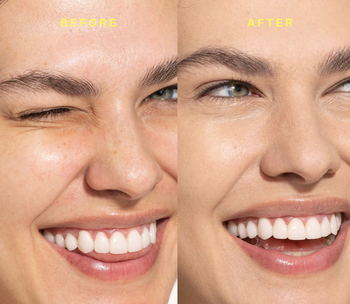 before and after shots of a model showing red-toned skin on the left, followed by a clear complexion after using the product on the right