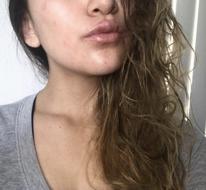 same reviewer with noticeably reduced redness