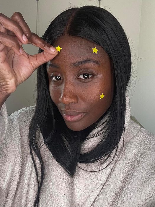 A different reviewer wearing several of the yellow star-shaped pimple patches on their face