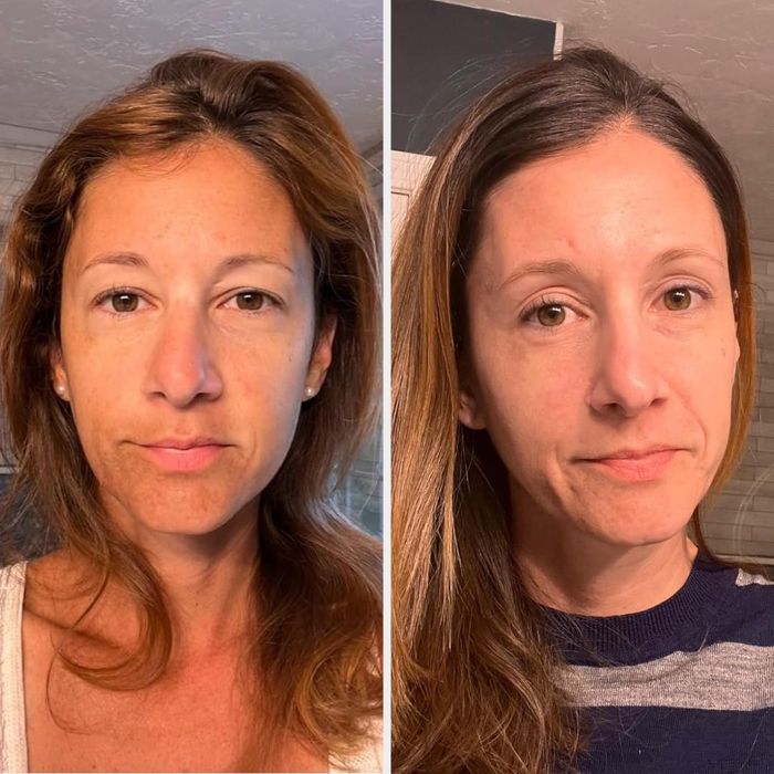 Before and after images of the Cosrx Snail Mucin, showing skin that appears brighter and more hydrated.