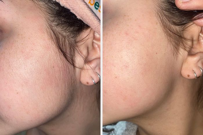 The reviewer is showing their cheek with visible hair, then showing the same cheek smooth and hair-free after using the touch-up tool.