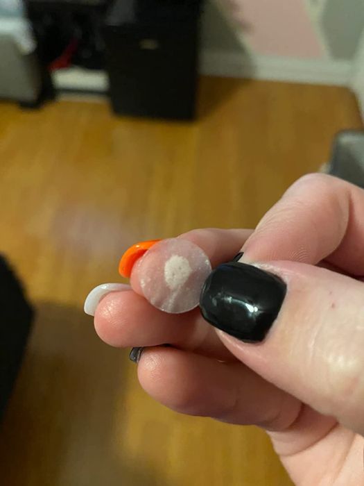 A reviewer shows the acne patch covered in gunk
