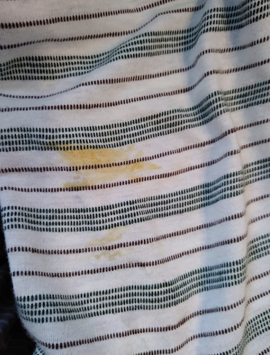 A white striped shirt with a visible yellow-orange stain