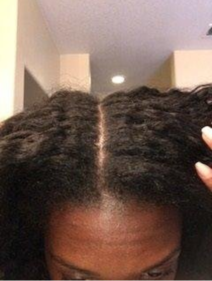 The same reviewer's scalp with no dandruff flakes visible around their part