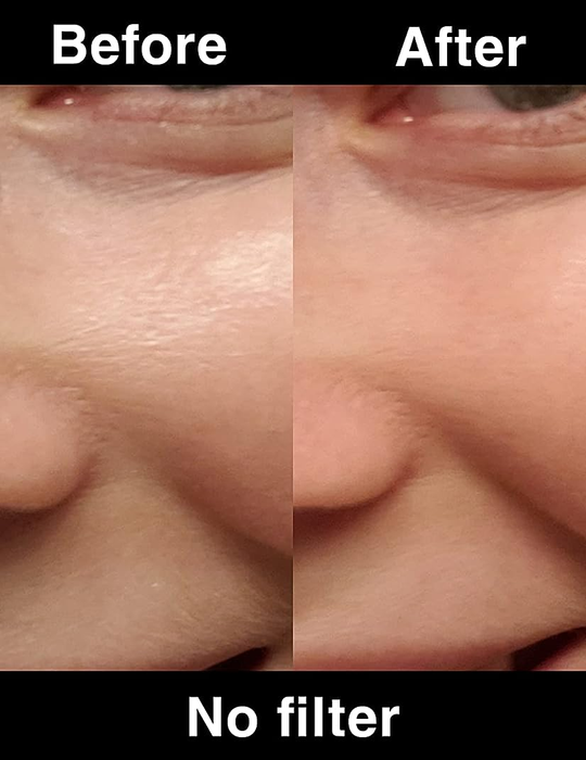 Before/after showing a face that was oily and looks matte after using the roller.