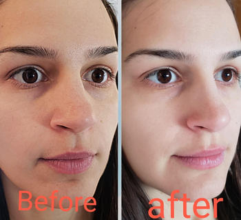 Before-and-after photos from a reviewer showing the effects of the bubble clay mask.