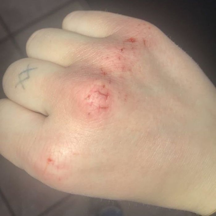 A before photo showing the reviewer's dry, cracked hands.