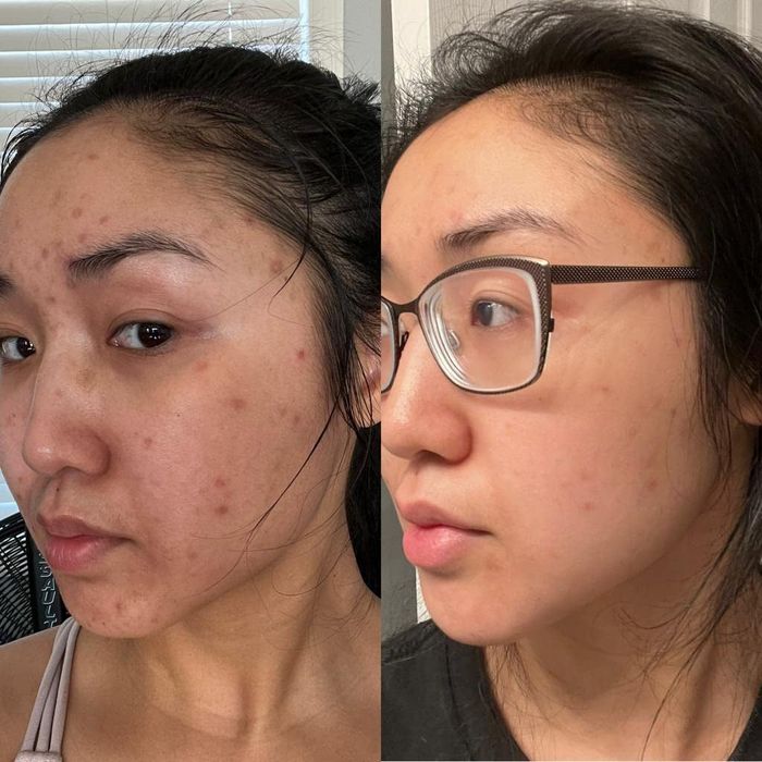 The review shows a significant fading of dark spots on the skin after using the product.