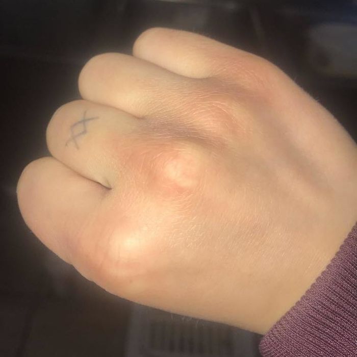 An after photo of the same reviewer's hand, now smooth and healed after using the hand cream.