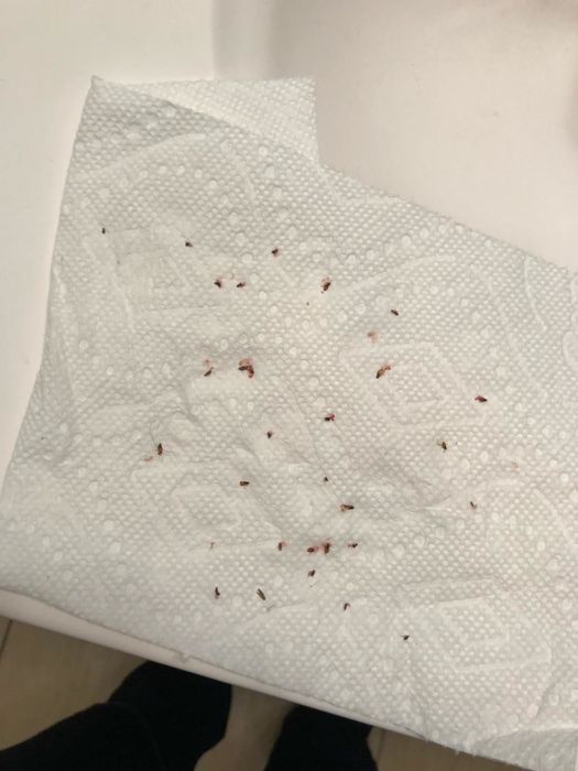 A paper towel covered with ticks that have been removed.