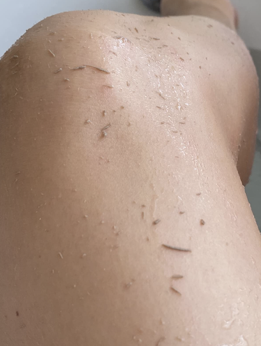 A customer's review photo showing the dead skin removed after using the mitt