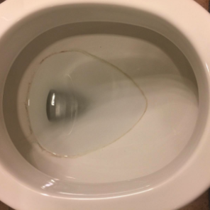A toilet bowl showing a stubborn stained ring inside