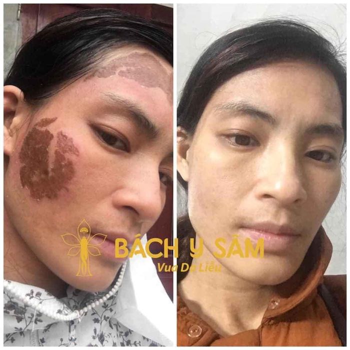 Phuong Anh Spa & Clinic Image 2