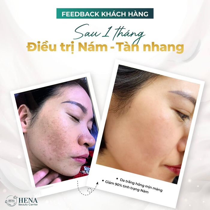 Hena Beauty Center Image 1
