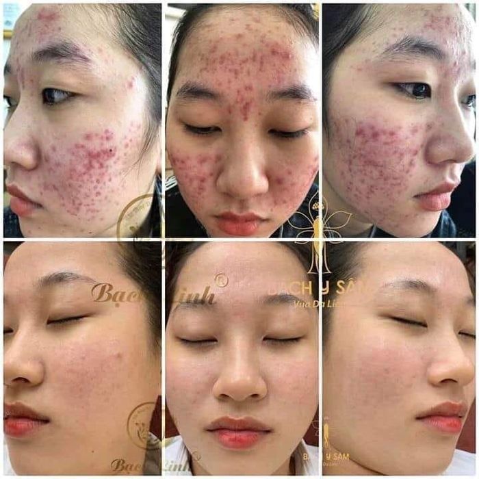 Phuong Anh Spa & Clinic Image 1