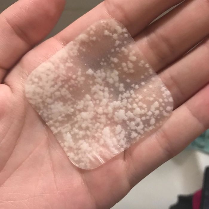 the acne patch with visible pus on it