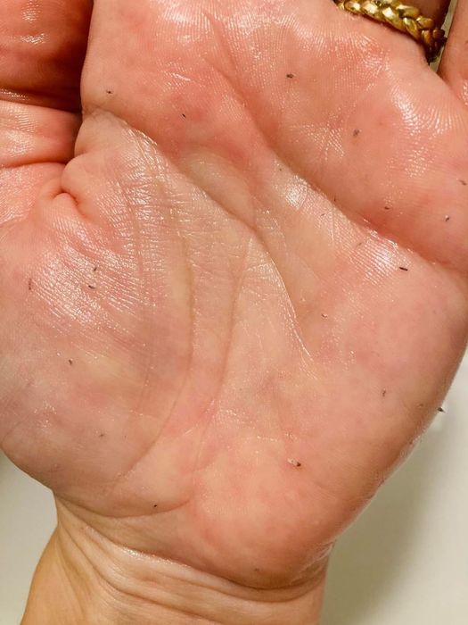 Reviewer's hand with cleansing oil applied