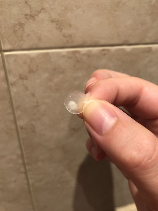 Mytour editor showing off the pimple patch they’ve used