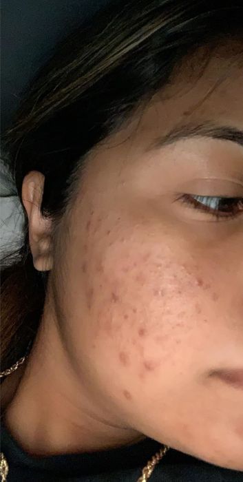Before using the serum: reviewer's skin
