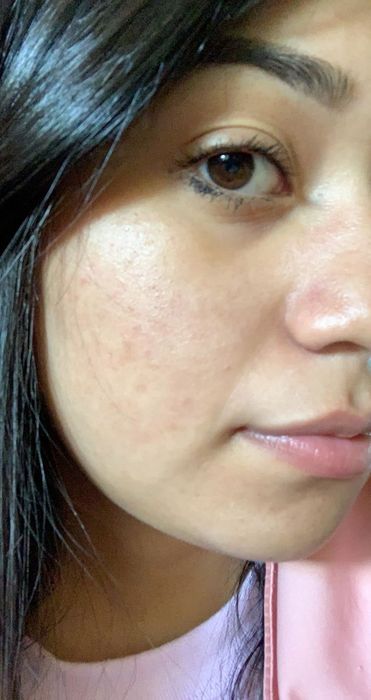 After using the serum: reviewer's skin