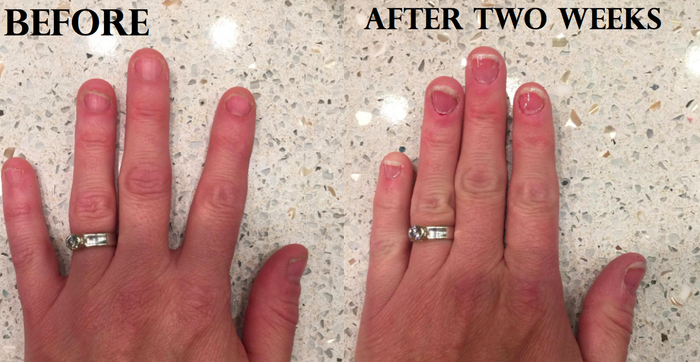 Side-by-side photos from a reviewer showcasing their nail growth