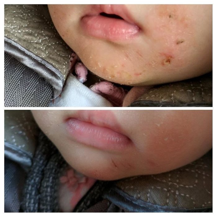 A reviewer's before-and-after photos showing their child's eczema before and after seven days of applying the moisturizing cream, with significant improvement.